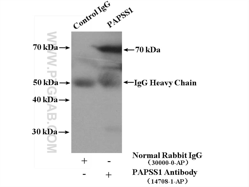 Immunoprecipitation (IP) experiment of HepG2 cells using PAPSS1 Polyclonal antibody (14708-1-AP)