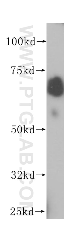 Western Blot (WB) analysis of Jurkat cells using PAPSS1 Polyclonal antibody (14708-1-AP)