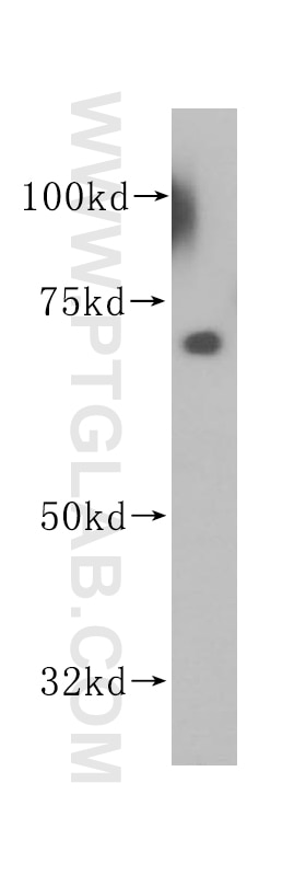 Western Blot (WB) analysis of HepG2 cells using PAPSS1 Polyclonal antibody (14708-1-AP)