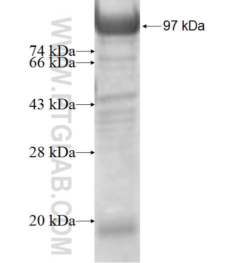 PAPSS1 fusion protein Ag6401 SDS-PAGE
