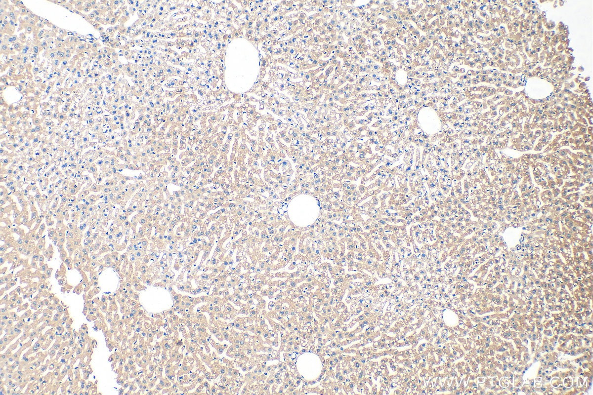 Immunohistochemistry (IHC) staining of mouse liver tissue using PAPSS2 Polyclonal antibody (15978-1-AP)