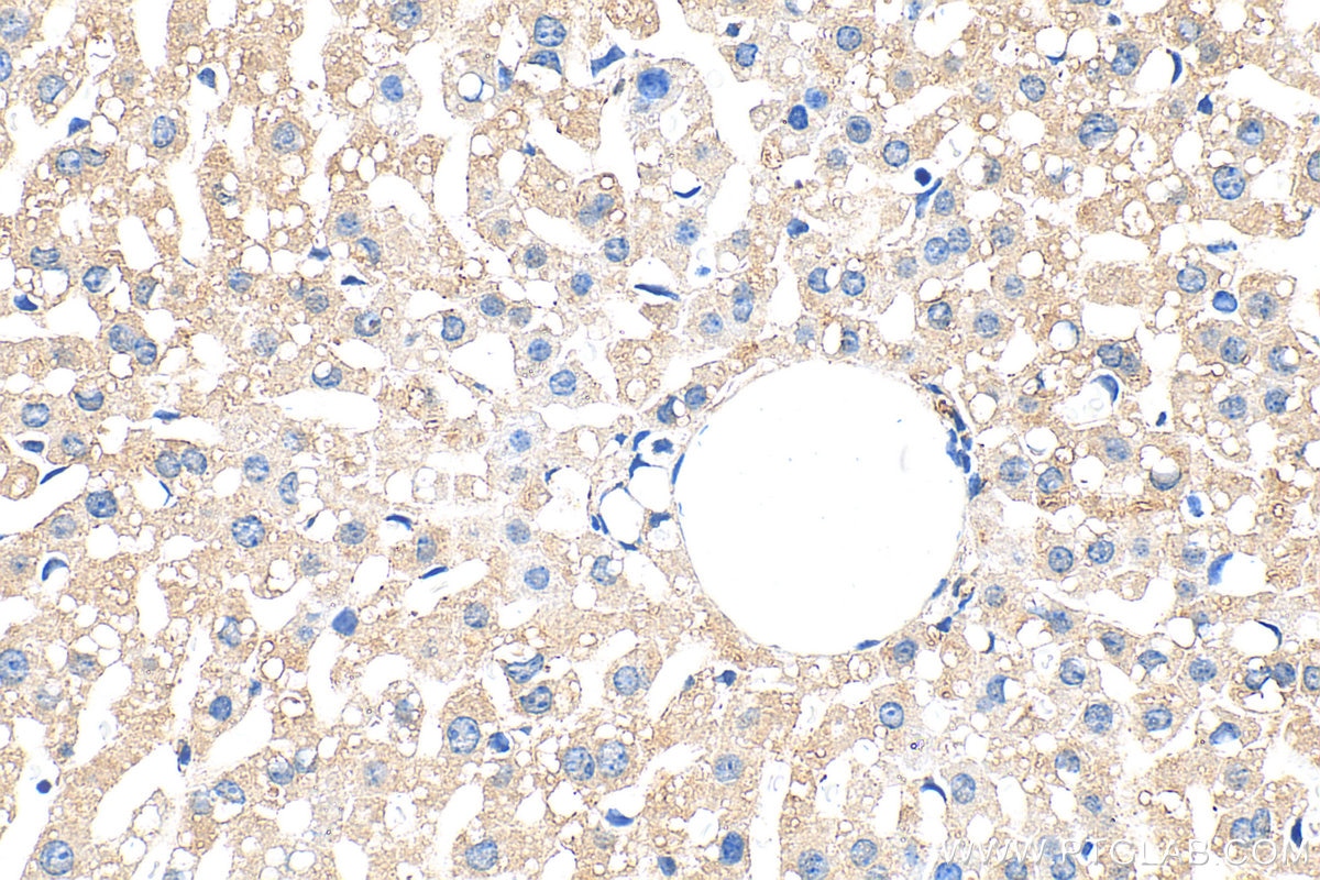 Immunohistochemistry (IHC) staining of mouse liver tissue using PAPSS2 Polyclonal antibody (15978-1-AP)