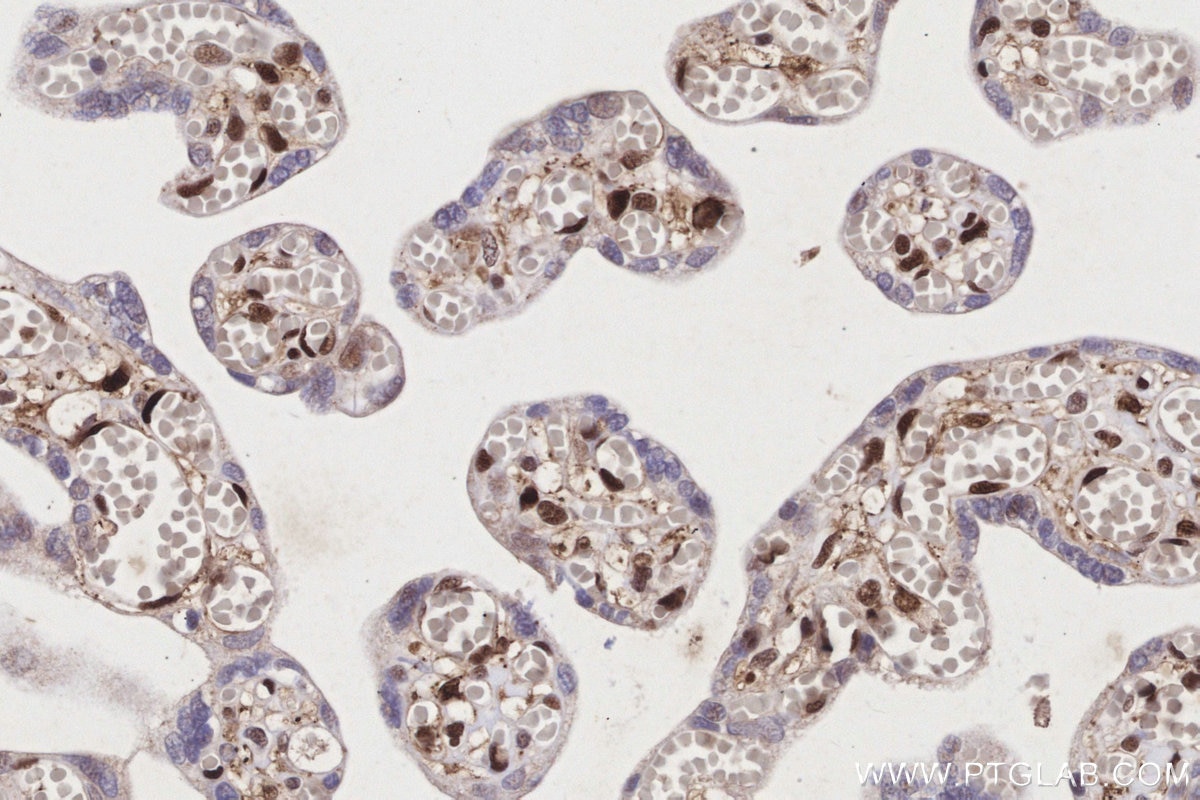 Immunohistochemistry (IHC) staining of human placenta tissue using PAPSS2 Polyclonal antibody (15978-1-AP)