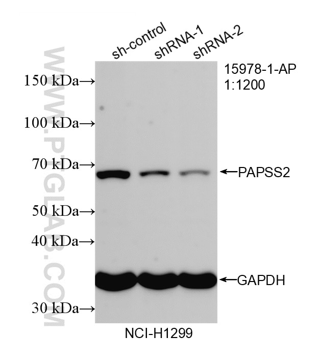 WB analysis of NCI-H1299 using 15978-1-AP Western Blot (WB) analysis of NCI-H1299 cells using PAPSS2 Polyclonal antibody (15978-1-AP)
