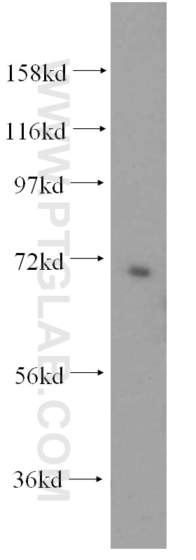 Western Blot (WB) analysis of HepG2 cells using PAPSS2 Polyclonal antibody (15978-1-AP)