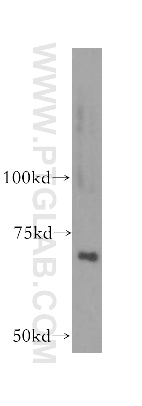 Western Blot (WB) analysis of human liver tissue using PAPSS2 Polyclonal antibody (15978-1-AP)