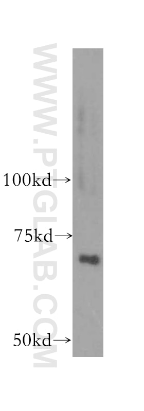 WB analysis of human liver using 15978-1-AP