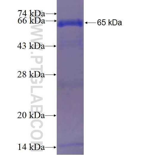 PAPSS2 fusion protein Ag8766 SDS-PAGE