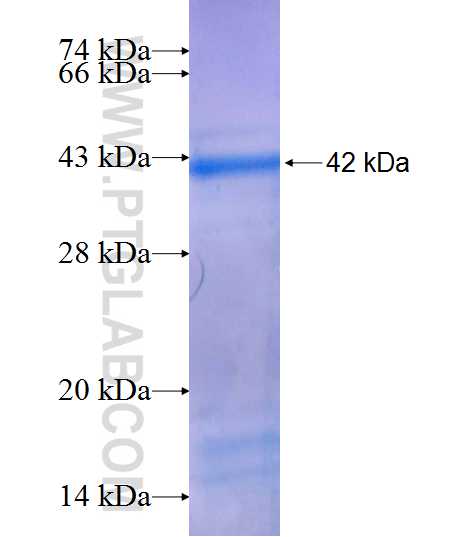 PAPSS2 fusion protein Ag8838 SDS-PAGE