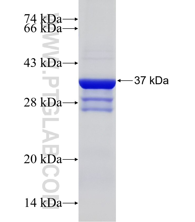 PAQR4 fusion protein Ag4241 SDS-PAGE