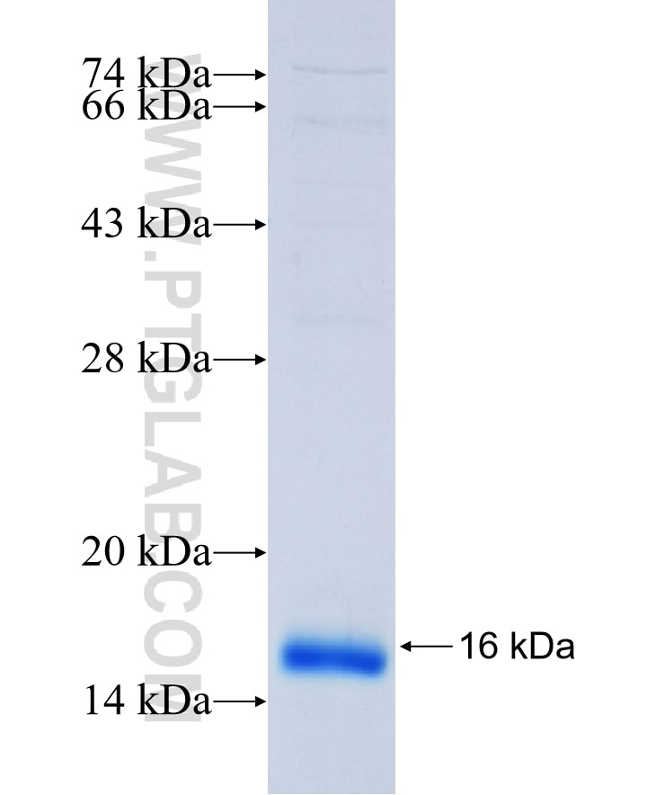 PAQR7 fusion protein Ag37141 SDS-PAGE PAQR7 fusion protein Ag37141 SDS-PAGE