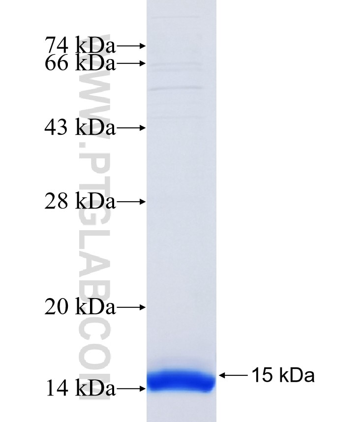 PAQR8 fusion protein Ag14509 SDS-PAGE
