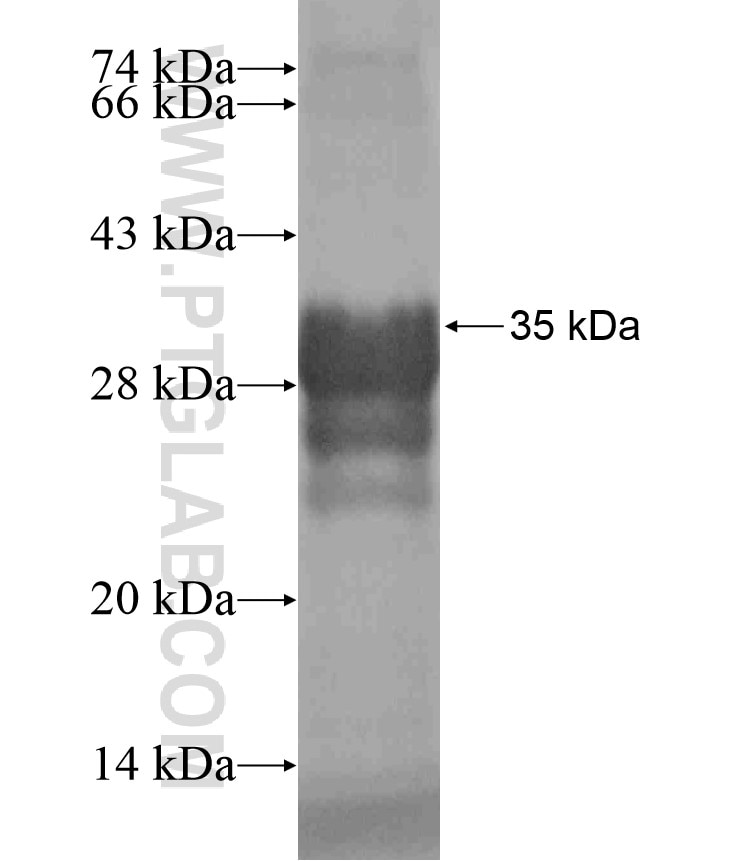 PAQR9 fusion protein Ag18113 SDS-PAGE