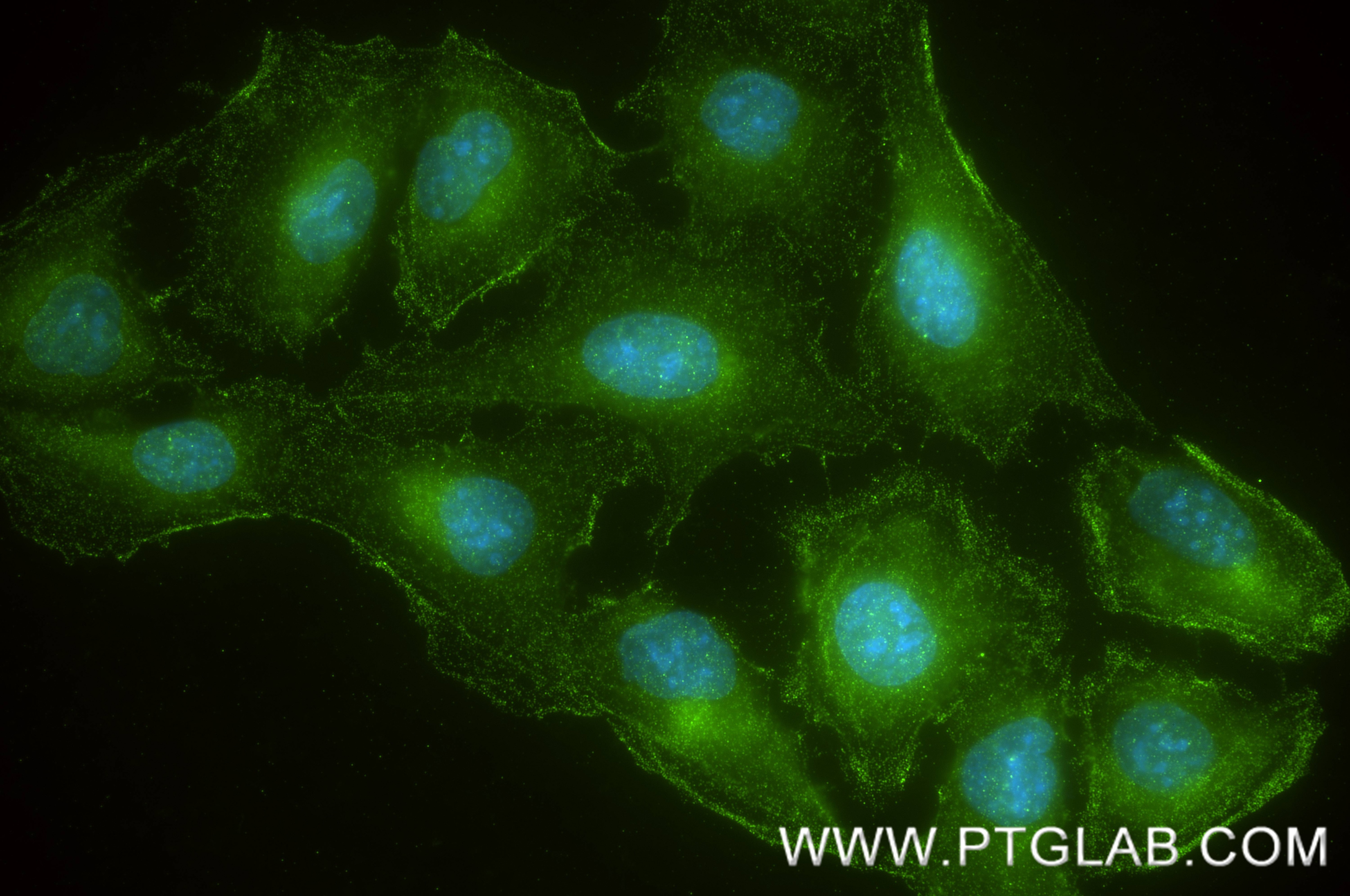 IF Staining of U2OS using 84593-1-RR Immunofluorescence (IF) / fluorescent staining of U2OS cells using PAR3 Recombinant monoclonal antibody (84593-1-RR)