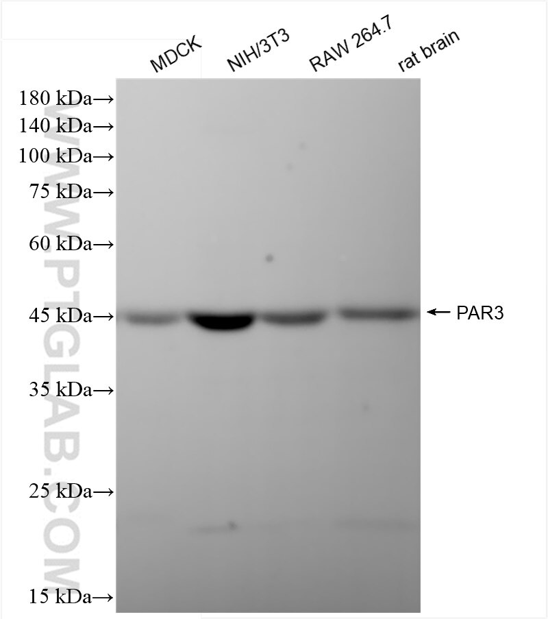 Western Blot (WB) analysis of various lysates using PAR3 Recombinant antibody (84593-1-RR)
