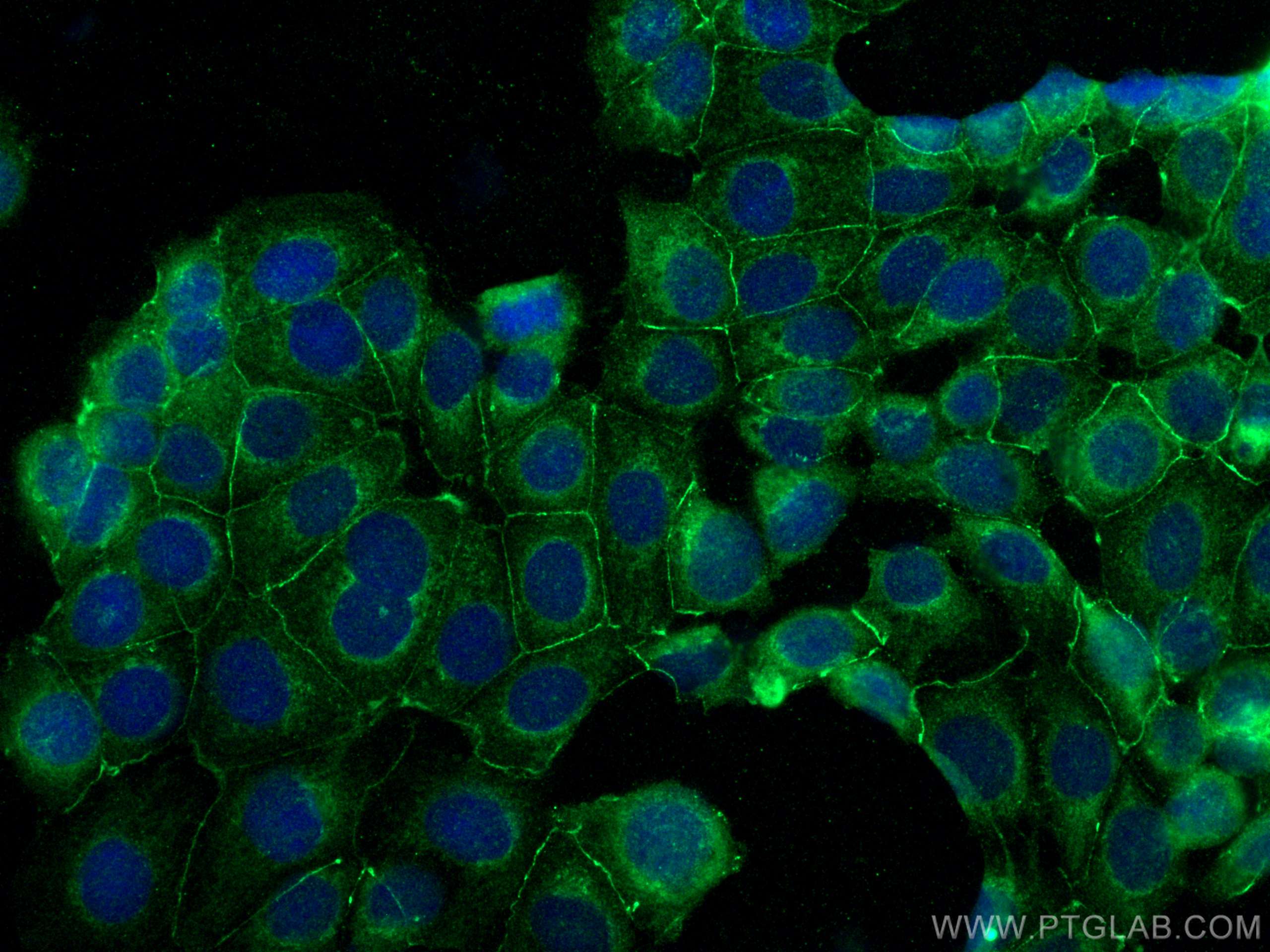 Immunofluorescence (IF) / fluorescent staining of MCF-7 cells using PARD3 Polyclonal antibody (11085-1-AP)