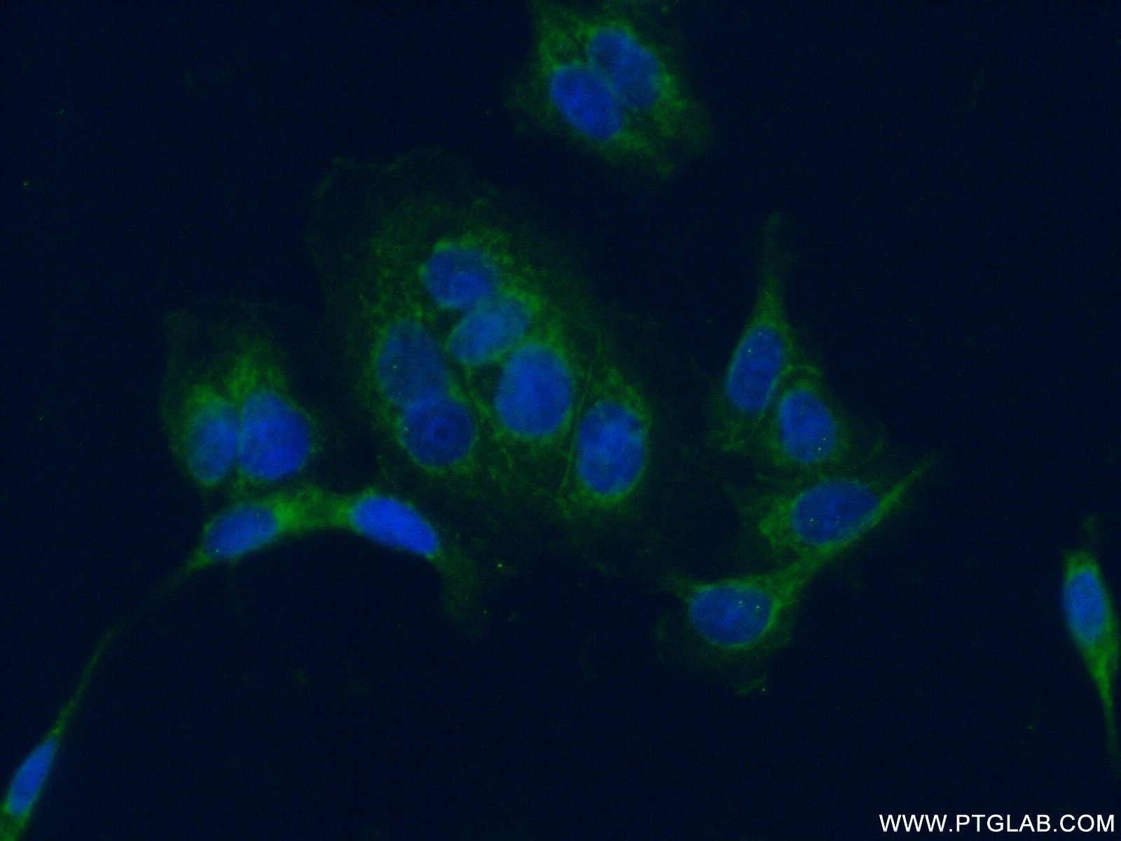 Immunofluorescence (IF) / fluorescent staining of MCF-7 cells using PARD3 Polyclonal antibody (11085-1-AP)