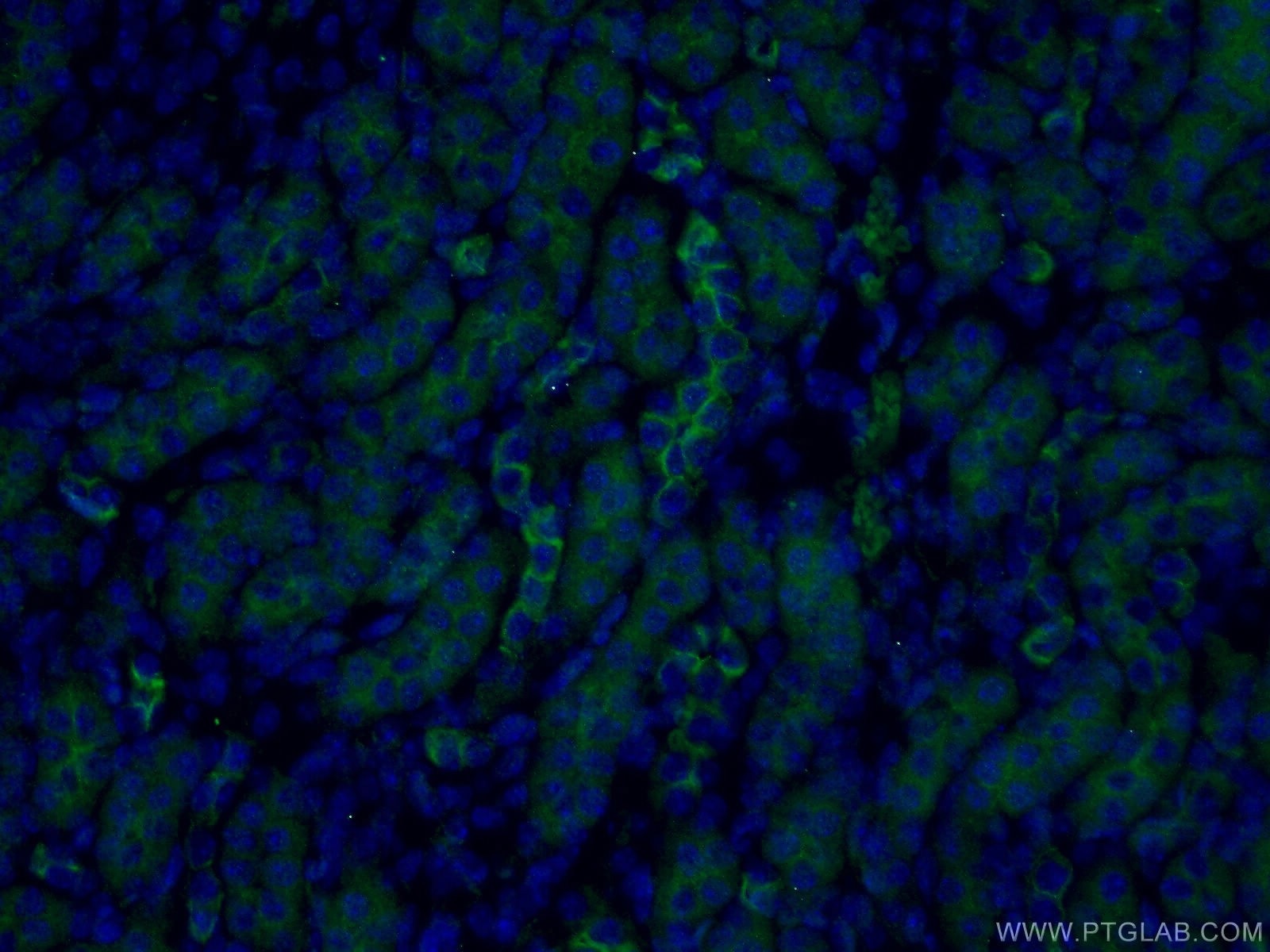 Immunofluorescence (IF) / fluorescent staining of mouse kidney tissue using PARD3 Polyclonal antibody (11085-1-AP)
