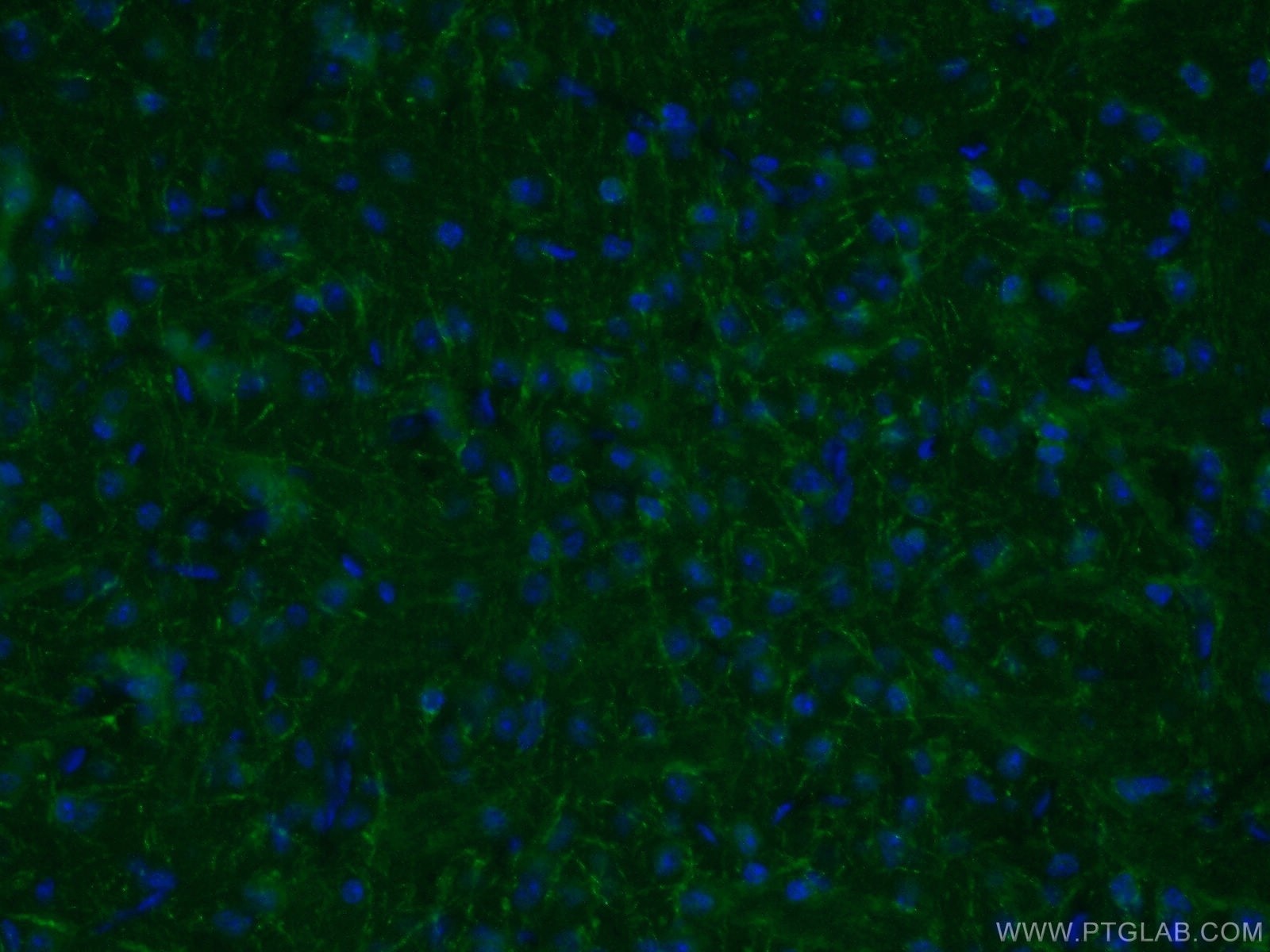 Immunofluorescence (IF) / fluorescent staining of mouse brain tissue using PARD3 Polyclonal antibody (11085-1-AP)