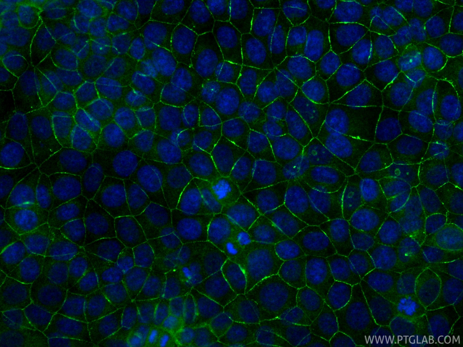 IF Staining of MCF-7 using 11085-1-AP Immunofluorescence (IF) / fluorescent staining of MCF-7 cells using PARD3 Polyclonal antibody (11085-1-AP)