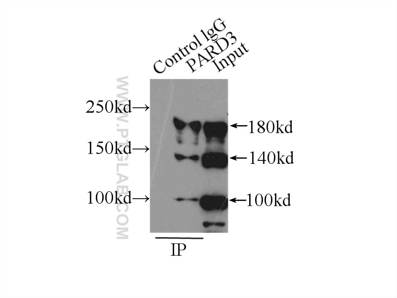 Immunoprecipitation (IP) experiment of MCF-7 cells using PARD3 Polyclonal antibody (11085-1-AP)