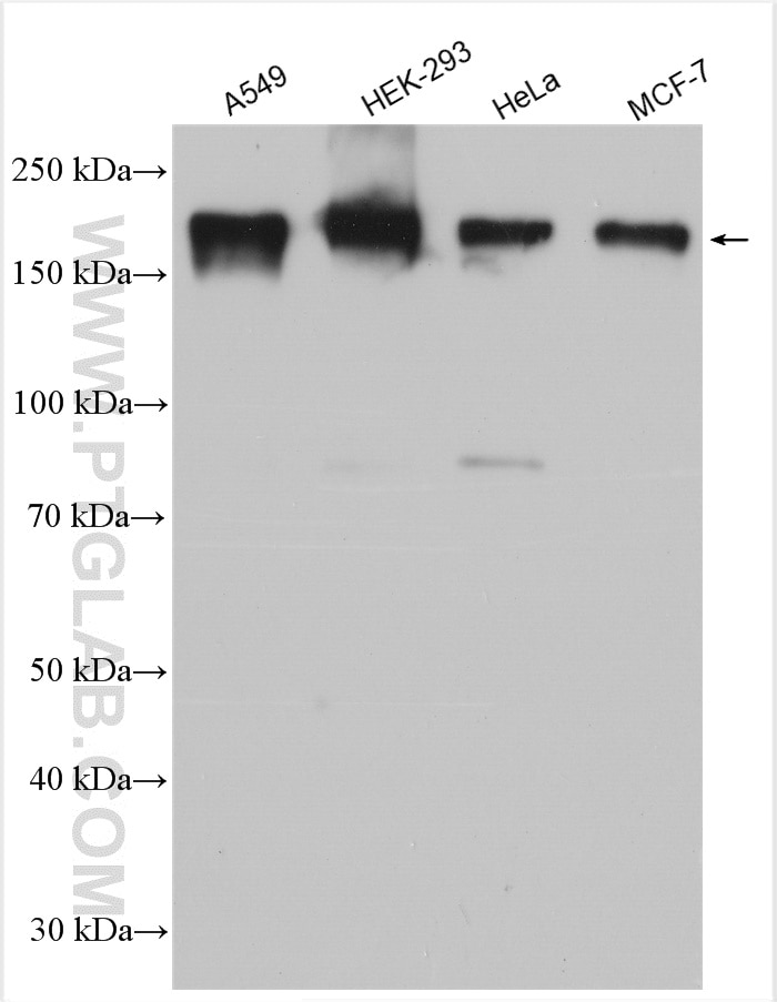 Western Blot (WB) analysis of various lysates using PARD3 Polyclonal antibody (11085-1-AP)