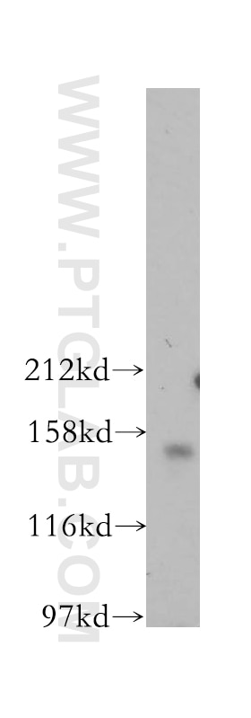 Western Blot (WB) analysis of MCF-7 cells using PARD3 Polyclonal antibody (11085-1-AP)