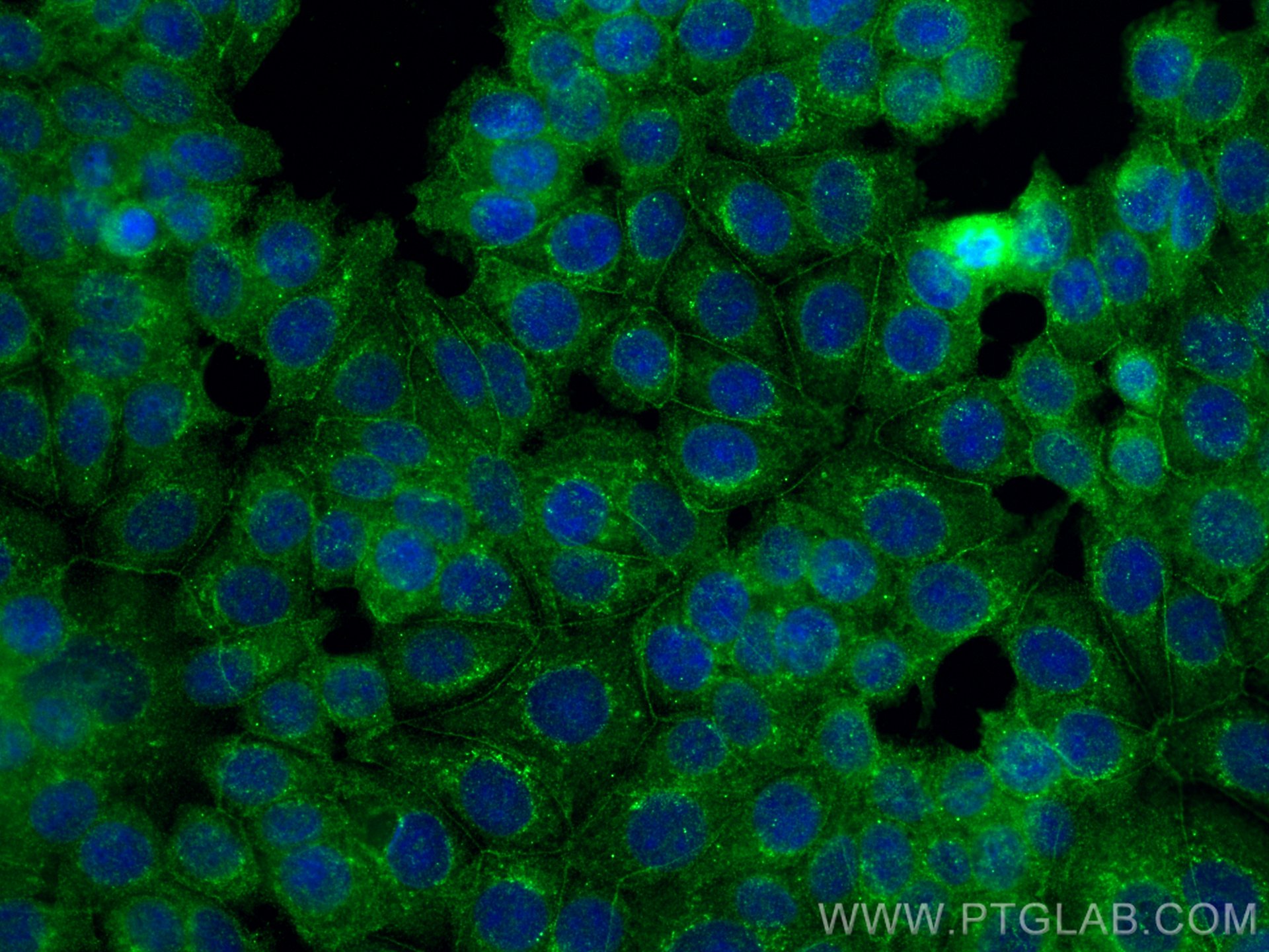 Immunofluorescence (IF) / fluorescent staining of MCF-7 cells using PARD3 Monoclonal antibody (66968-1-Ig)