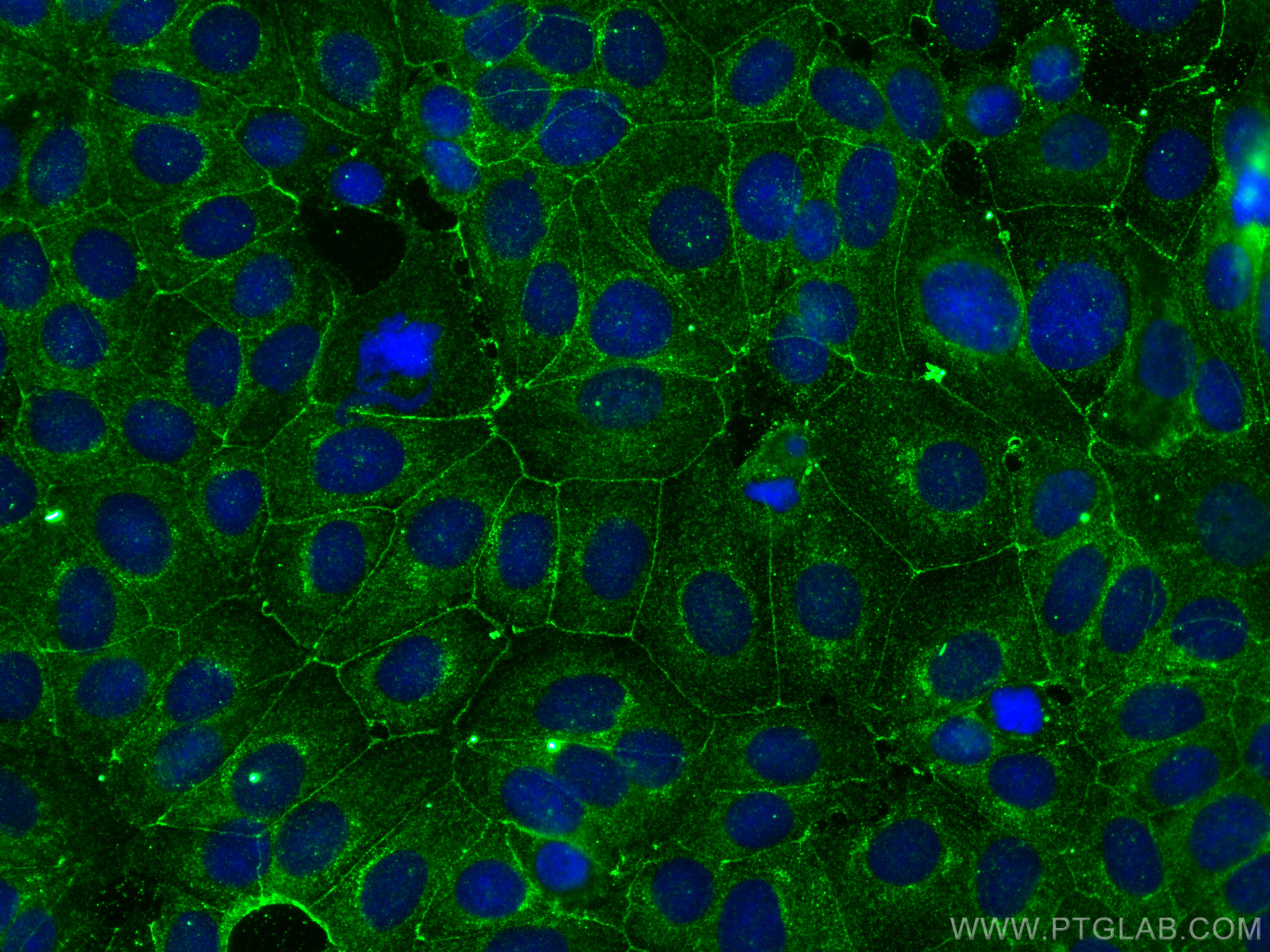 Immunofluorescence (IF) / fluorescent staining of MCF-7 cells using PARD3 Monoclonal antibody (66968-1-Ig)