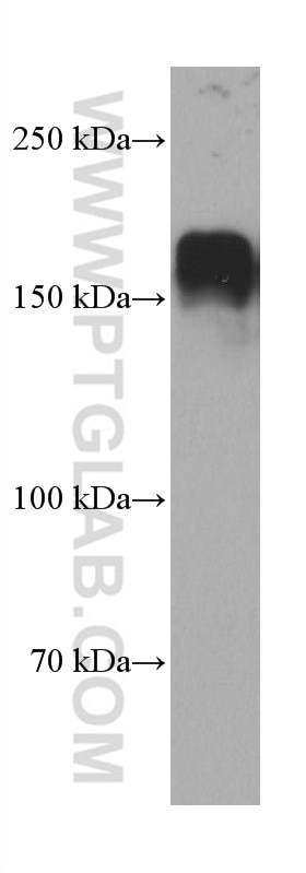 Western Blot (WB) analysis of HeLa cells using PARD3 Monoclonal antibody (66968-1-Ig)