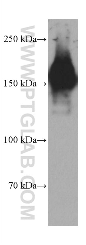 Western Blot (WB) analysis of HEK-293 cells using PARD3 Monoclonal antibody (66968-1-Ig)