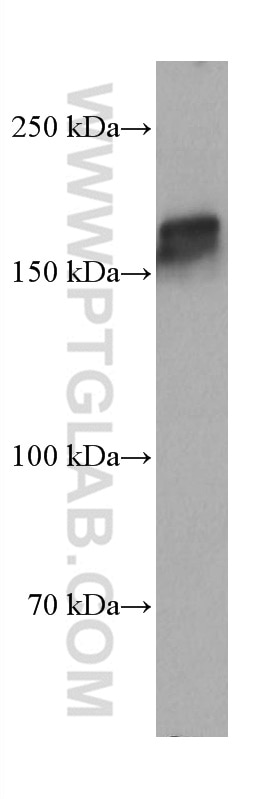 Western Blot (WB) analysis of A431 cells using PARD3 Monoclonal antibody (66968-1-Ig)