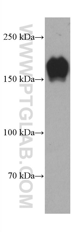 Western Blot (WB) analysis of MCF-7 cells using PARD3 Monoclonal antibody (66968-1-Ig)