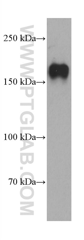Western Blot (WB) analysis of HepG2 cells using PARD3 Monoclonal antibody (66968-1-Ig)