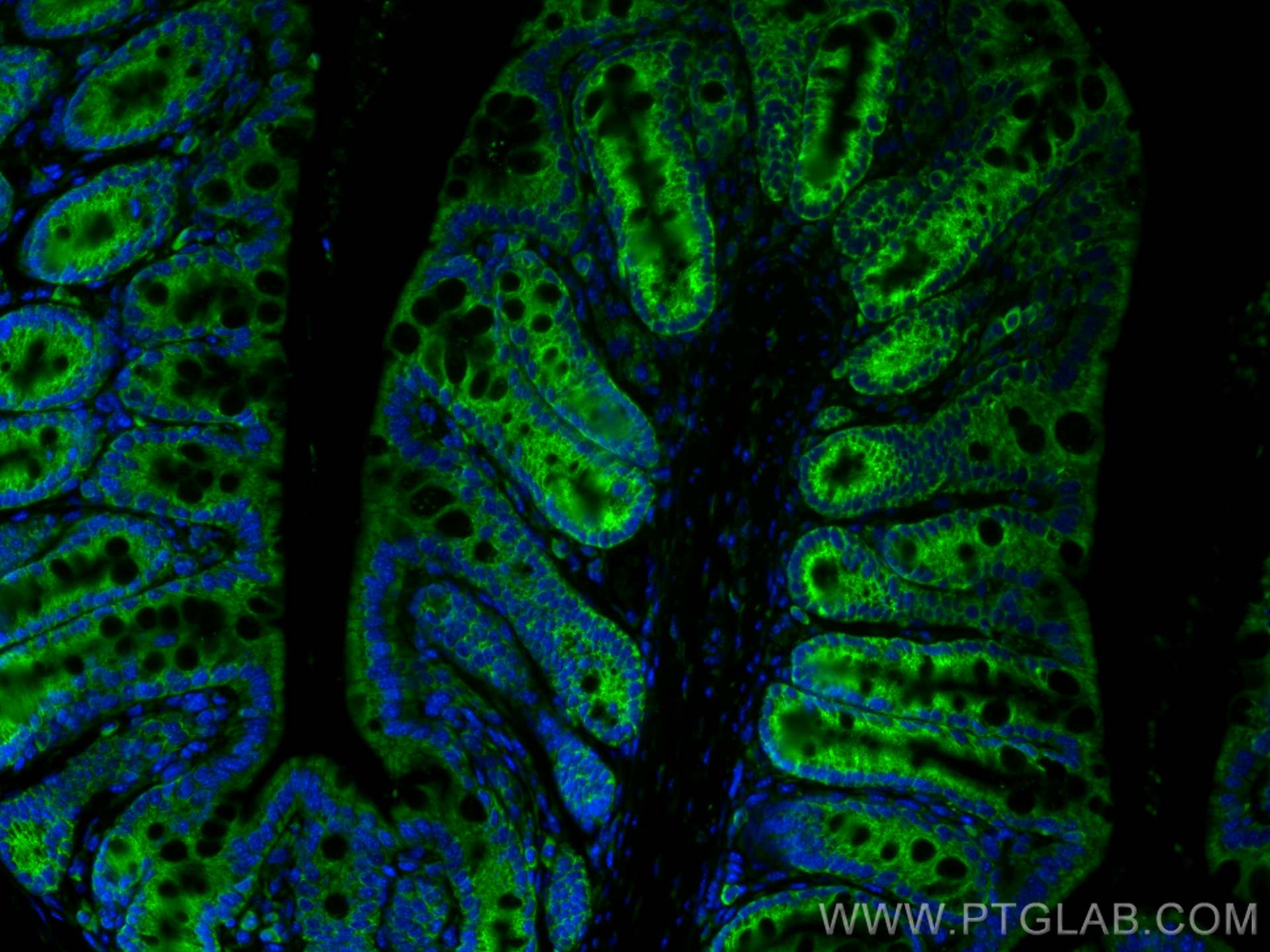 Immunofluorescence (IF) / fluorescent staining of mouse colon tissue using CoraLite® Plus 488-conjugated PARD3 Polyclonal ant (CL488-11085)