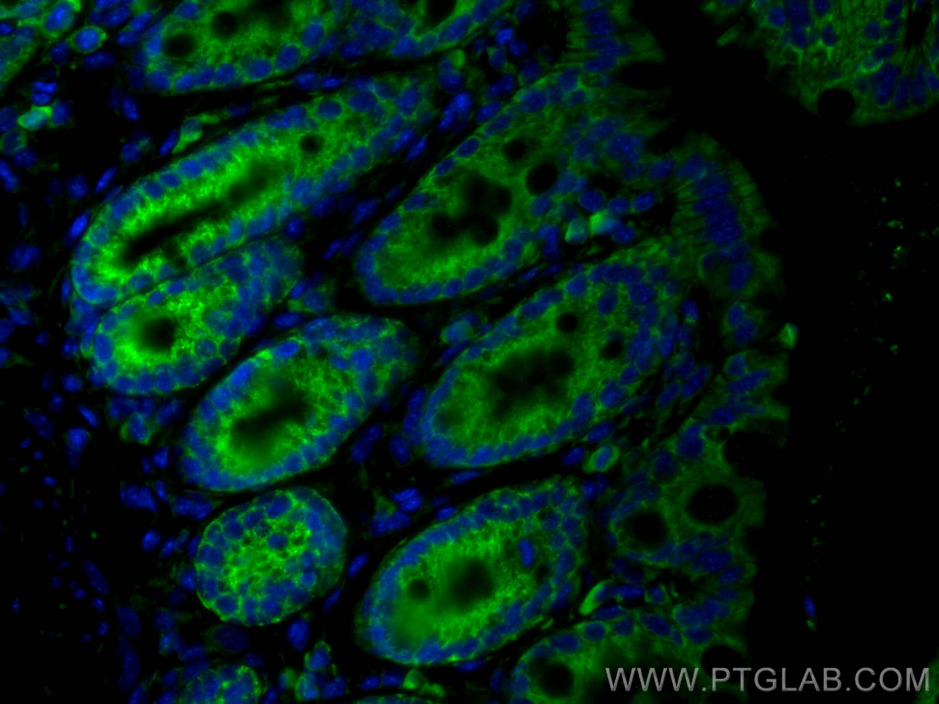 IF Staining of mouse colon using CL488-11085