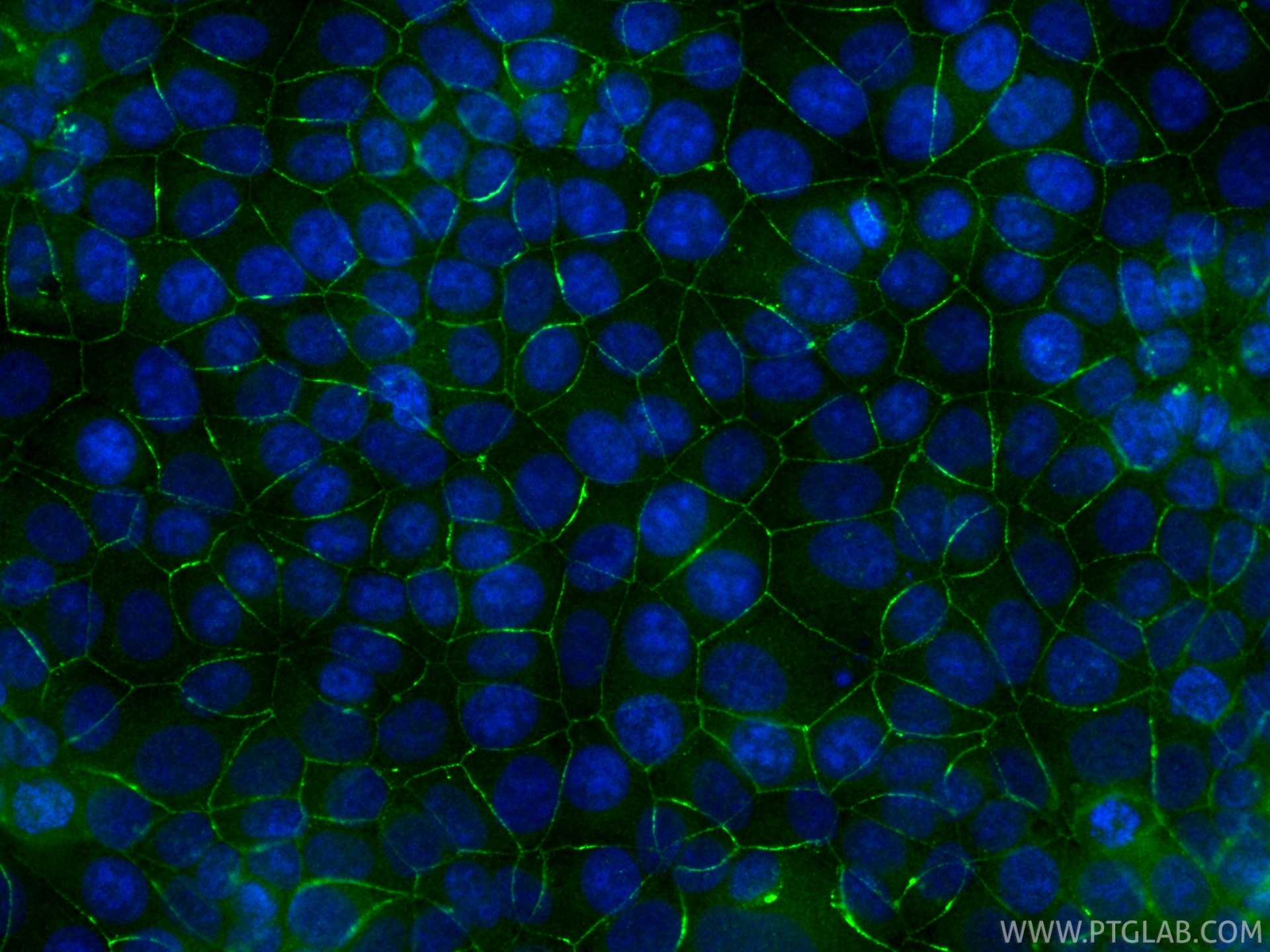 IF Staining of MCF-7 using CL488-11085 Immunofluorescence (IF) / fluorescent staining of MCF-7 cells using CoraLite® Plus 488-conjugated PARD3 Polyclonal ant (CL488-11085)