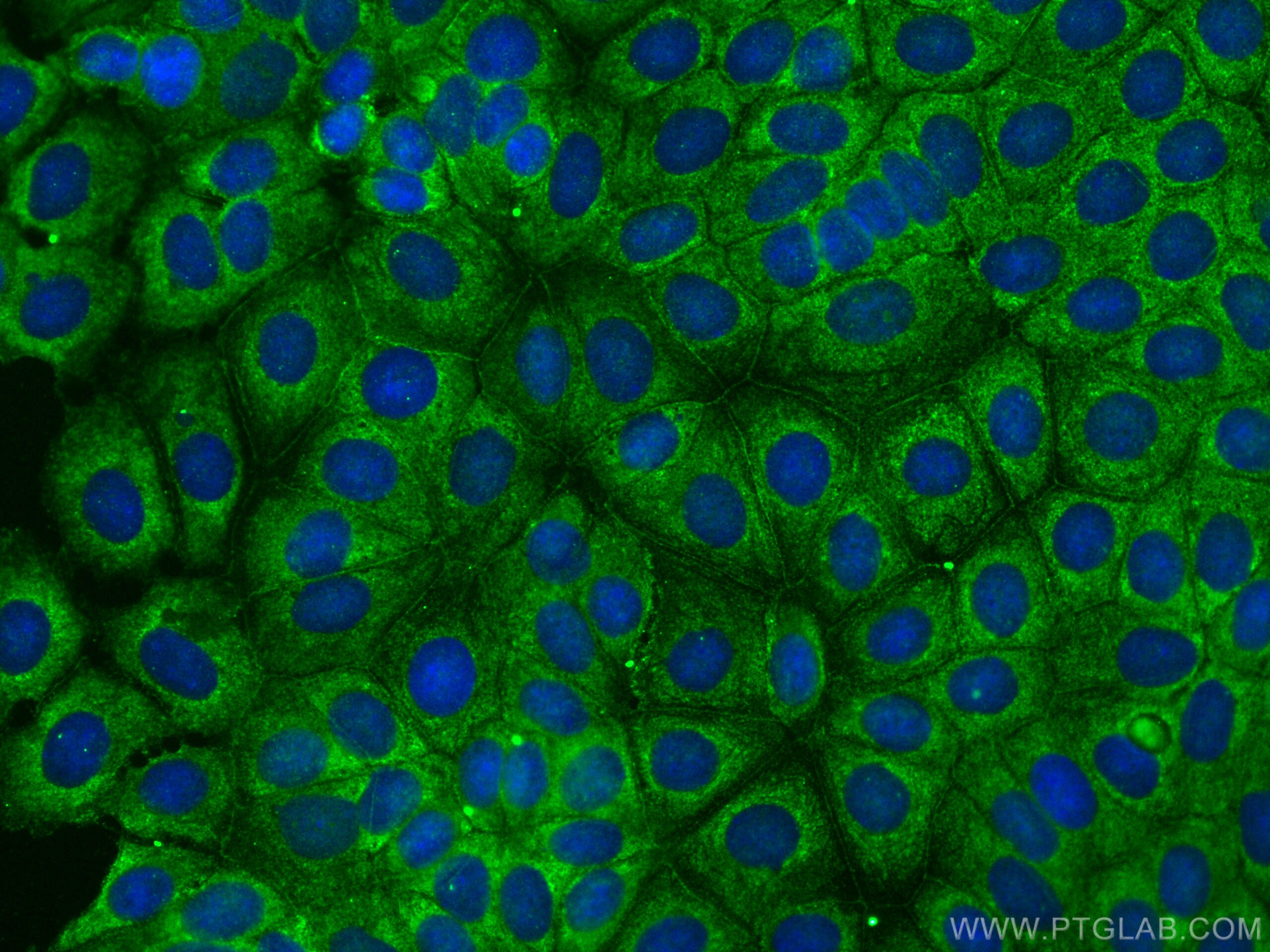 Immunofluorescence (IF) / fluorescent staining of MCF-7 cells using CoraLite® Plus 488-conjugated PARD3 Monoclonal ant (CL488-66968)