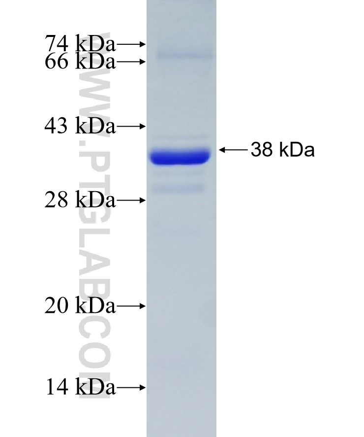 PARD3 fusion protein Ag7656 SDS-PAGE