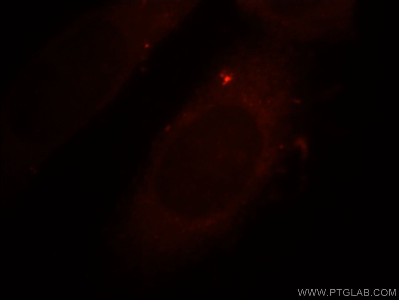 Immunofluorescence (IF) / fluorescent staining of MCF-7 cells using PARD6B Polyclonal antibody (13996-1-AP)