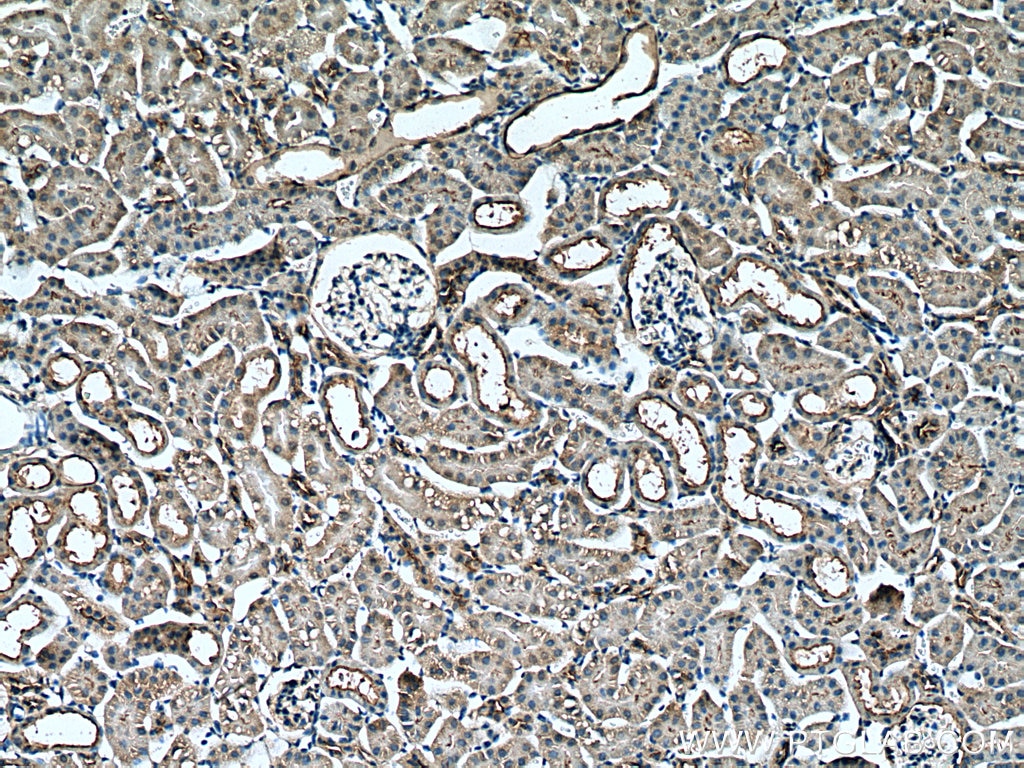 Immunohistochemistry (IHC) staining of mouse kidney tissue using PARD6B Polyclonal antibody (13996-1-AP)