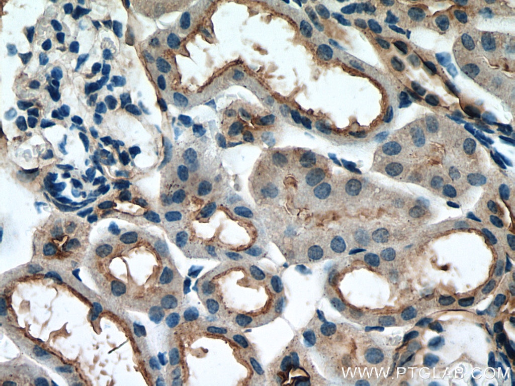 Immunohistochemistry (IHC) staining of mouse kidney tissue using PARD6B Polyclonal antibody (13996-1-AP)