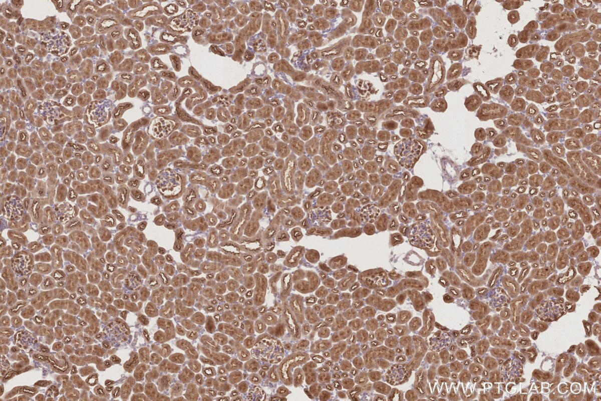 Immunohistochemistry (IHC) staining of mouse kidney tissue using PARD6B Polyclonal antibody (13996-1-AP)