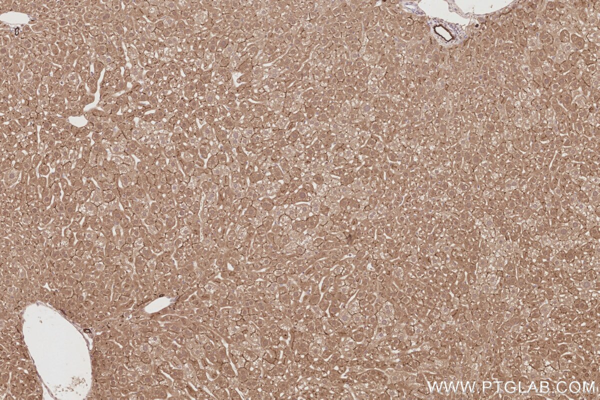 Immunohistochemistry (IHC) staining of mouse liver tissue using PARD6B Polyclonal antibody (13996-1-AP)
