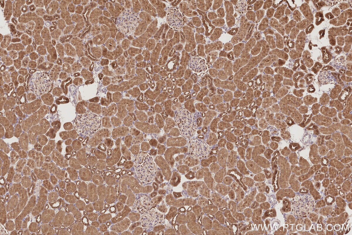 Immunohistochemistry (IHC) staining of rat kidney tissue using PARD6B Polyclonal antibody (13996-1-AP)
