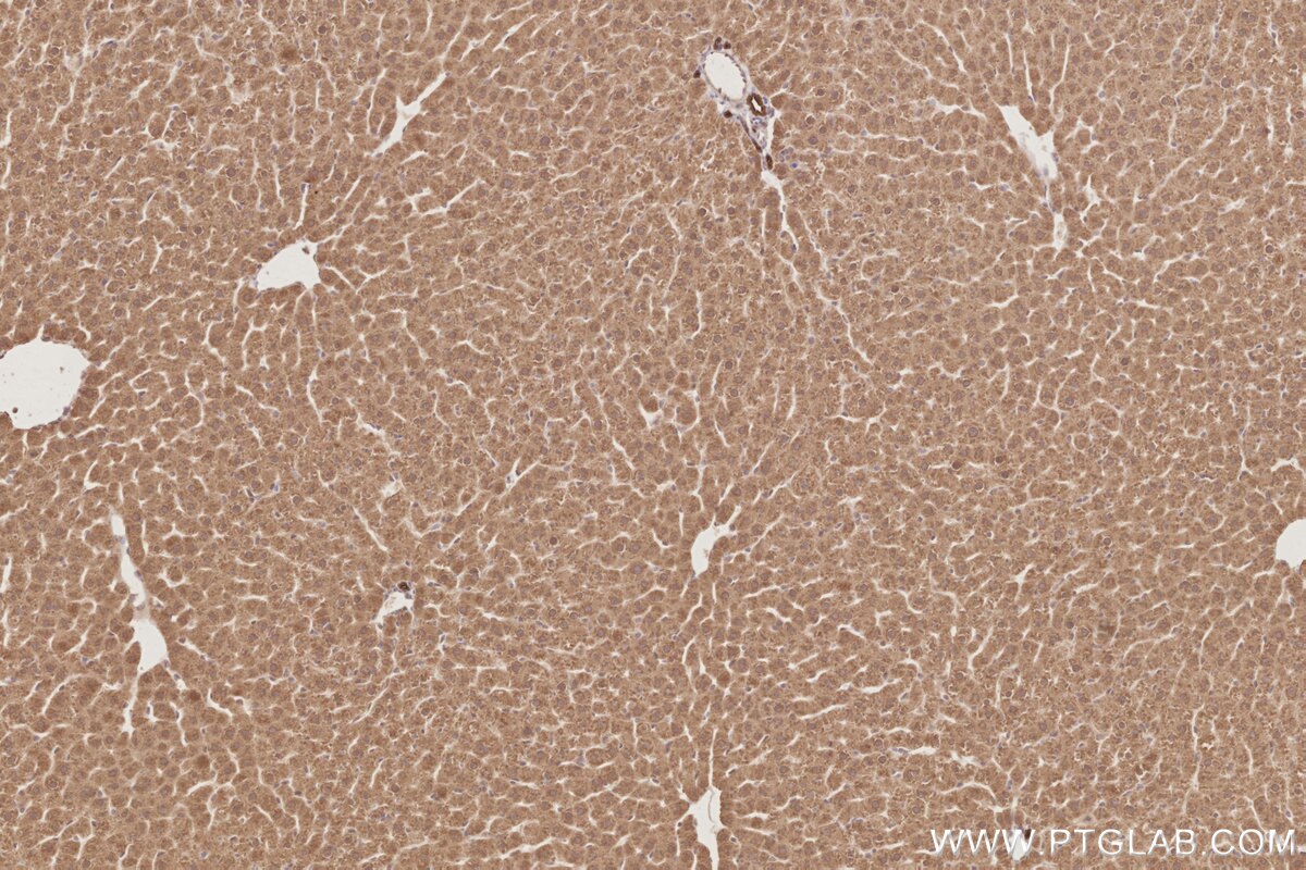 Immunohistochemistry (IHC) staining of rat liver tissue using PARD6B Polyclonal antibody (13996-1-AP)