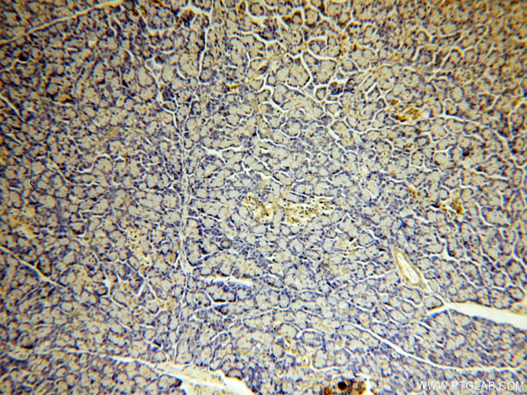 Immunohistochemistry (IHC) staining of human pancreas tissue using PARD6B Polyclonal antibody (13996-1-AP)