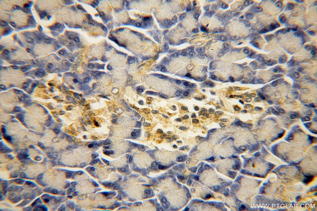 Immunohistochemistry (IHC) staining of human pancreas tissue using PARD6B Polyclonal antibody (13996-1-AP)