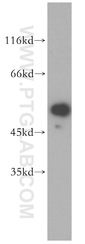 Western Blot (WB) analysis of HeLa cells using PARD6B Polyclonal antibody (13996-1-AP)