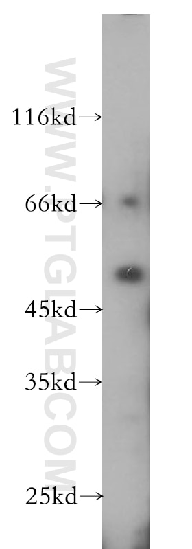 Western Blot (WB) analysis of human placenta tissue using PARD6B Polyclonal antibody (13996-1-AP)